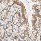 Anti-TBC1D8B Antibody