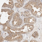 Immunohistochemical staining of human prostate shows strong cytoplasmic positivity in glandular cells.