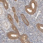 Immunohistochemical staining of human endometrium shows strong cytoplasmic positivity in glandular cells.