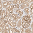 Immunohistochemical staining of human kidney shows strong cytoplasmic positivity in cells in tubules.