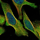 Immunofluorescent staining of human cell line U-2 OS shows localization to cytosol.
