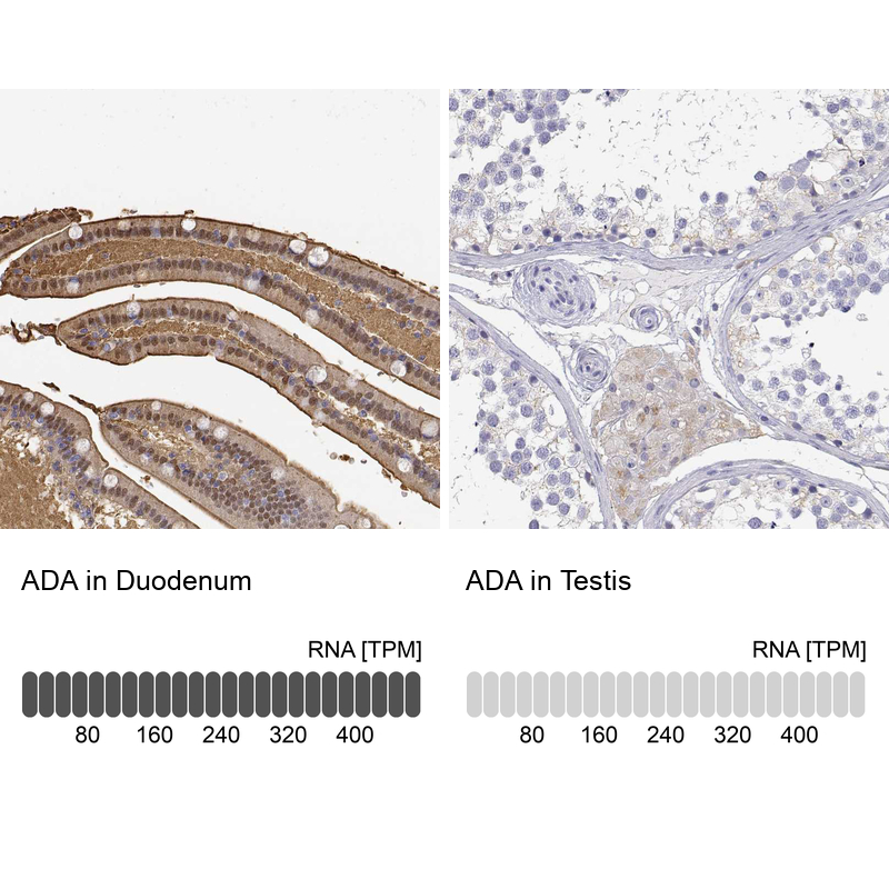 Anti-ADA Antibody