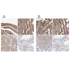 Immunohistochemical staining of human duodenum, small intestine, stomach and testis using Anti-ADA antibody HPA023884 (A) shows similar protein distribution across tissues to independent antibody HPA001399 (B).