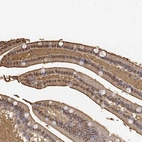 Immunohistochemical staining of human duodenum shows strong membranous and cytoplasmic positivity in glandular cells.