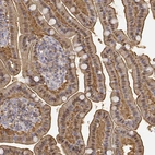 Immunohistochemical staining of human small intestine shows strong membranous and cytoplasmic positivity in glandular cells.