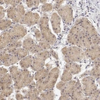 Immunohistochemical staining of human stomach shows moderate cytoplasmic positivity in glandular cells.