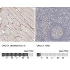 Anti-DMD Antibody