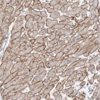 Anti-DMD Antibody