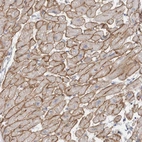 Immunohistochemical staining of human heart muscle shows strong membranous positivity in myocytes.