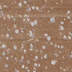 Immunohistochemical staining of human cerebral cortex shows strong cytoplasmic positivity in neuropil.