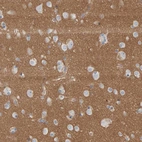 Immunohistochemical staining of human cerebral cortex shows strong cytoplasmic positivity in neuropil.