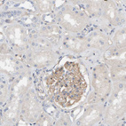 Immunohistochemical staining of human kidney shows moderate cytoplasmic positivity in cells in glomeruli.