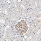 Immunohistochemical staining of human kidney shows moderate cytoplasmic positivity in cells in glomeruli.