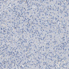 Anti-FYN Antibody