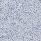 Immunohistochemical staining of human pancreas shows no positivity in exocrine glandular cells as expected.