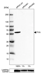 Western blot analysis in U-87MG ATCC cells transfected with control siRNA, target specific siRNA probe #1 and #2, using Anti-FYN antibody. Remaining relative intensity is presented. Loading control: Anti-GAPDH.