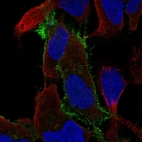 Immunofluorescent staining of human cell line AF22 shows localization to plasma membrane.