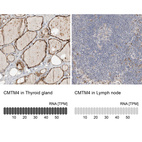 Anti-CMTM4 Antibody