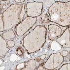 Immunohistochemical staining of human thyroid gland shows high expression.