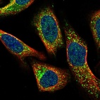 Immunofluorescent staining of human cell line U-2 OS shows localization to vesicles.
