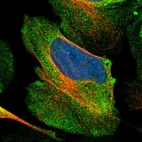 Immunofluorescent staining of human cell line U-2 OS shows localization to plasma membrane & cytosol.