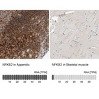 Anti-NFKB2 Antibody