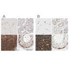Immunohistochemical staining of human cerebral cortex, kidney, lymph node and testis using Anti-NFKB2 antibody HPA023900 (A) shows similar protein distribution across tissues to independent antibody HPA008422 (B).