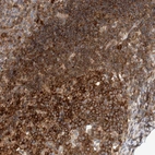 Immunohistochemical staining of human appendix shows high expression.
