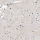 Immunohistochemical staining of human skeletal muscle shows low expression as expected.