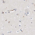 Immunohistochemical staining of human cerebral cortex using Anti-NFKB2 antibody HPA023900.