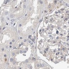 Immunohistochemical staining of human kidney using Anti-NFKB2 antibody HPA023900.