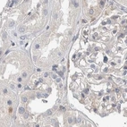 Immunohistochemical staining of human kidney using Anti-NFKB2 antibody HPA023900.
