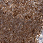 Immunohistochemical staining of human lymph node using Anti-NFKB2 antibody HPA023900.