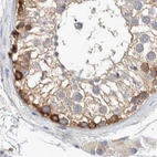 Immunohistochemical staining of human testis using Anti-NFKB2 antibody HPA023900.
