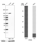 Western blot analysis in human cell lines A-431 and HeLa using Anti-NFKB2 antibody. Corresponding NFKB2 RNA-seq data are presented for the same cell lines. Loading control: Anti-PPIB.