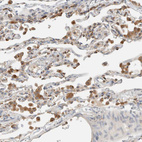 Anti-RAB11FIP1 Antibody