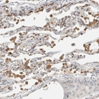 Immunohistochemical staining of human Lung shows moderate granular cytoplasmic positivity in macrophages.