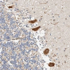 Immunohistochemical staining of human Cerebellum shows strong granular cytoplasmic positivity in Purkinje cells.