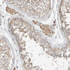 Immunohistochemical staining of human testis shows moderate granular cytoplasmic positivity in Leydig cells and cells in seminiferous ducts.