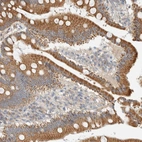 Immunohistochemical staining of human Duodenum shows strong granular cytoplasmic positivity in glandular cells.
