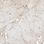 Immunohistochemical staining of human skeletal muscle shows very weak granular cytoplasmic positivity in myocytes.