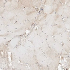 Immunohistochemical staining of human skeletal muscle shows very weak granular cytoplasmic positivity in myocytes.