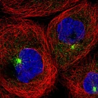 Immunofluorescent staining of human cell line A-431 shows localization to vesicles.