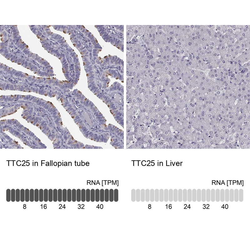 Anti-TTC25 Antibody