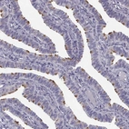 Immunohistochemical staining of human fallopian tube shows strong cytoplasmic positivity in ciliated cells.