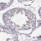 Immunohistochemical staining of human testis shows weak cytoplasmic positivity in cells in seminiferous ducts.