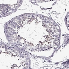 Immunohistochemical staining of human testis shows weak cytoplasmic positivity in cells in seminiferous ducts.
