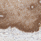 Immunohistochemical staining of human esophagus shows strong membranous/cytoplasmic positivity in squamous epithelial cells.