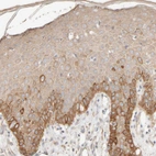 Immunohistochemical staining of human skin shows strong membranous/cytoplasmic positivity in squamous epithelial cells.