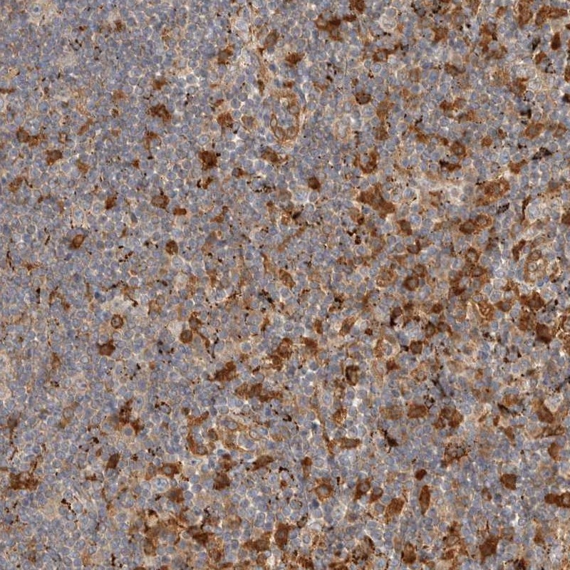 Anti-FAM167A Antibody